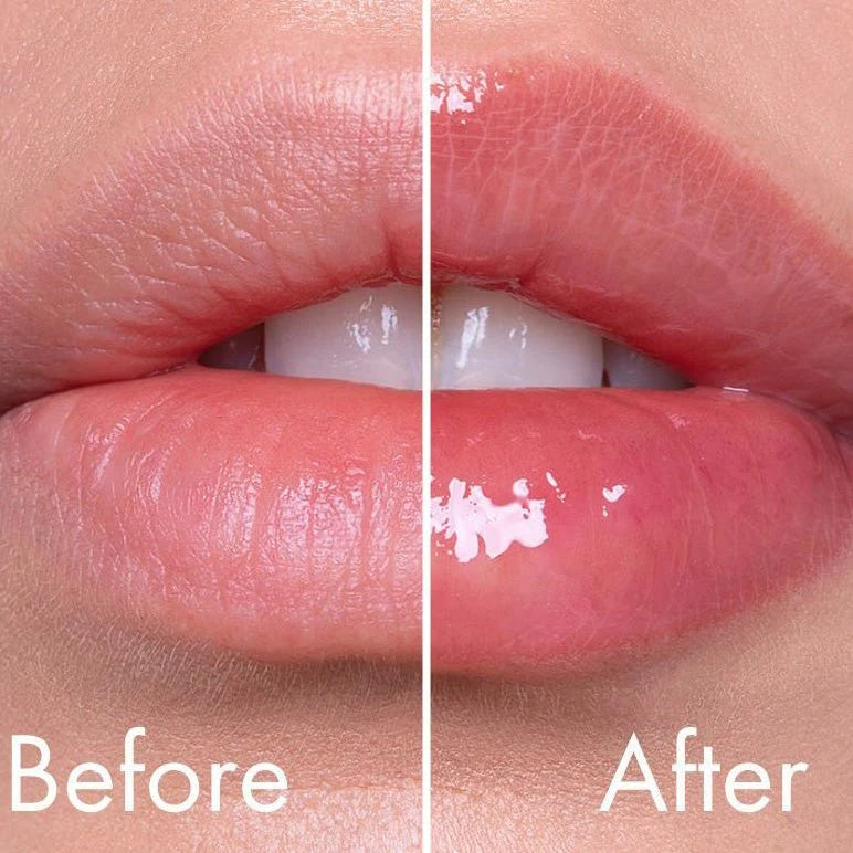 VT - Reedle Shot Lip Plumper TWINKLE 4,3g