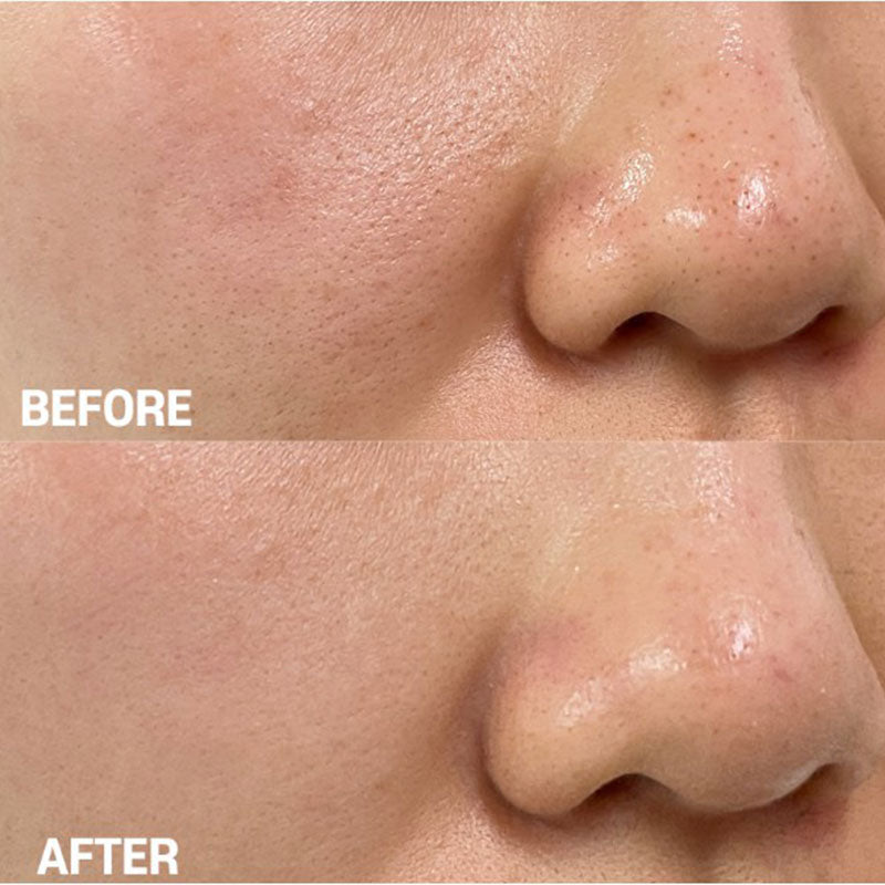 TIAM - Pore Minimizing 21 Serum 40ml