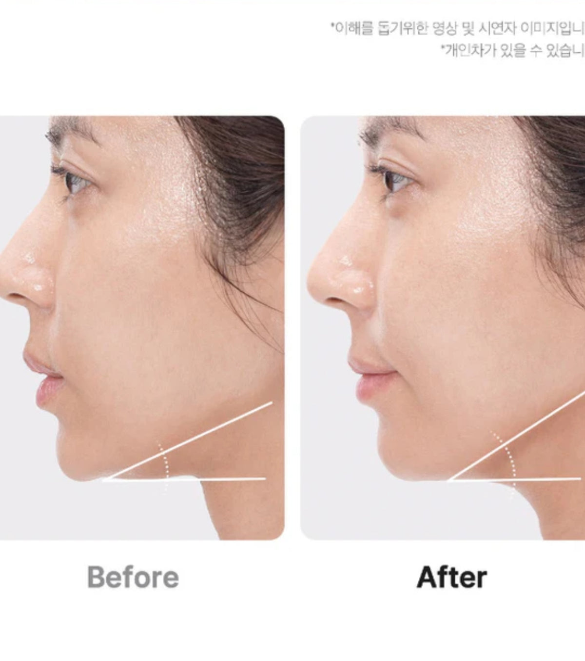 medicube - AGE-R Booster Face Roller Head Only